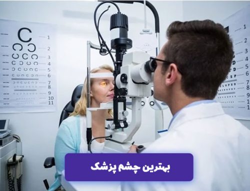 بهترین دکتر چشم در تهران کیست