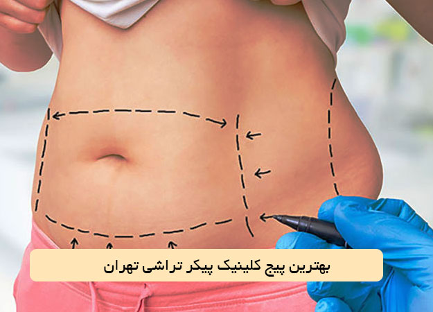 بهترین پیج کلینیک پیکر تراشی تهران